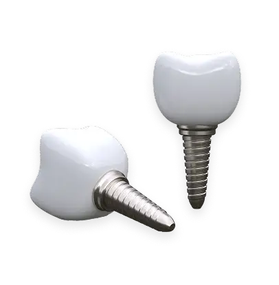 インプラントの写真